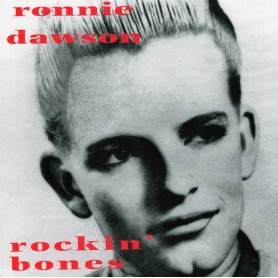Ronnie Dawson